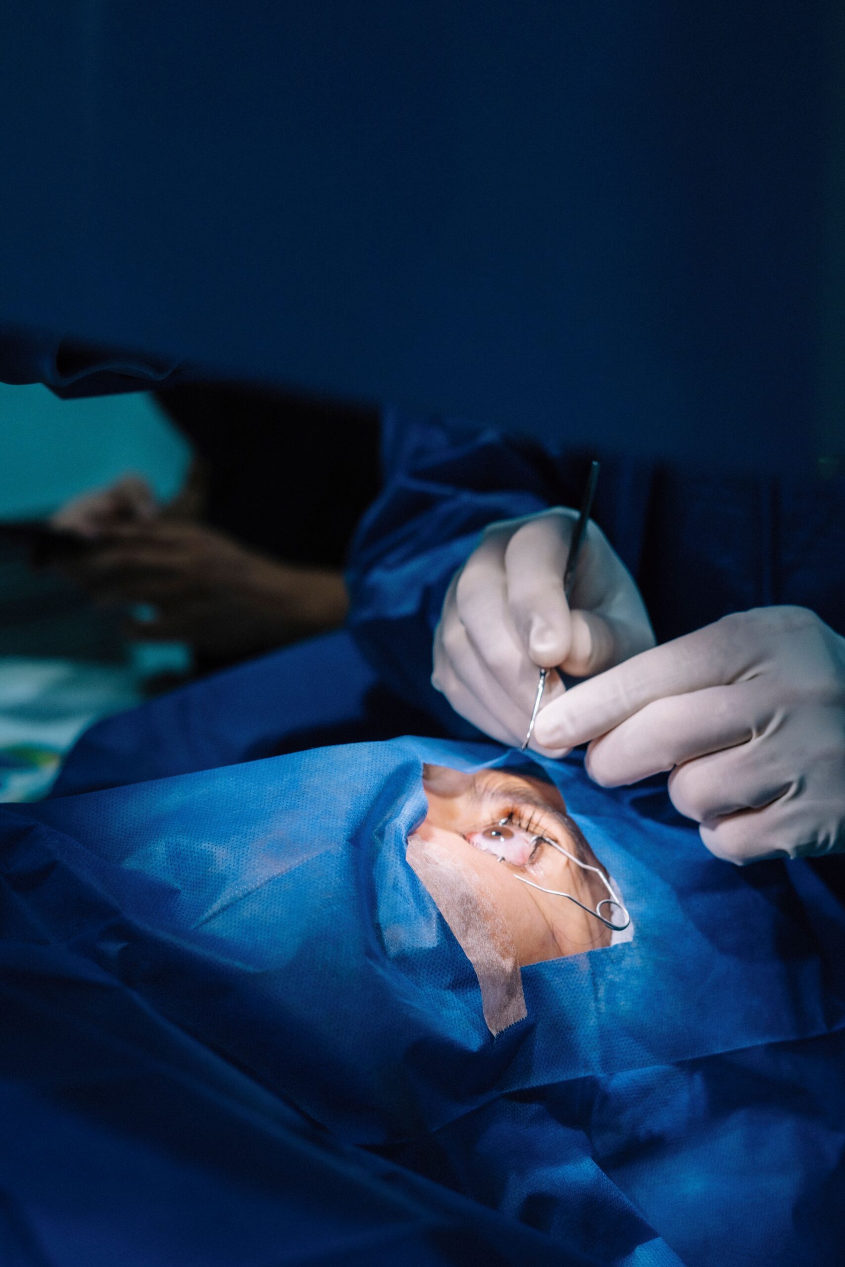 SMILE ve LASIK Arasındaki Temel Farklar Nelerdir?
